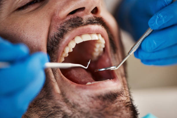Best Tooth Infection Emergency Dentist  in Hermitage, PA